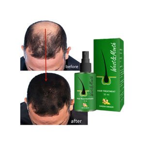 West Month Hair Care Herbal Regrowth Anti Loss Gingseng Biotin Hair Growth Oil Green Ginger Hair Essential Oil